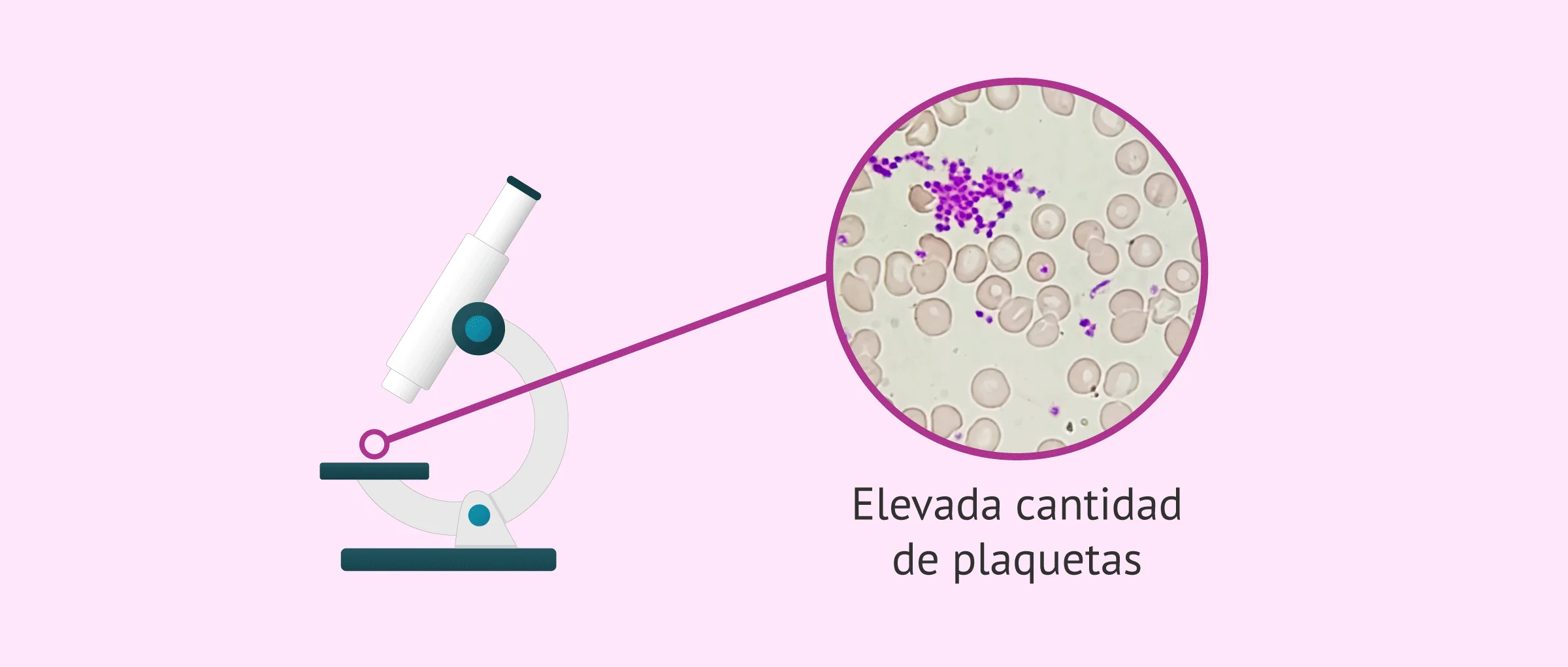 aferesis plaquetaria cuanto sube