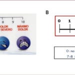 ¿Cuántas gotas de metoclopramida? cuantas-gotas-de-metoclopramida