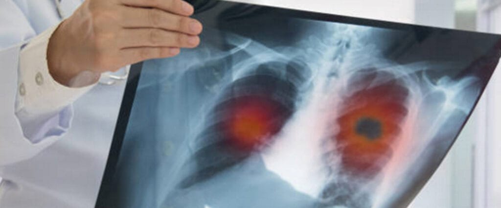 cuanto cobra un neumologo