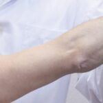 cuanto-cobra-un-traumatologo