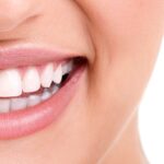 cuanto-cobran-por-poner-brackets
