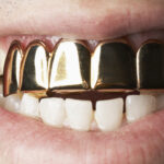 cuanto-cuesta-el-platino