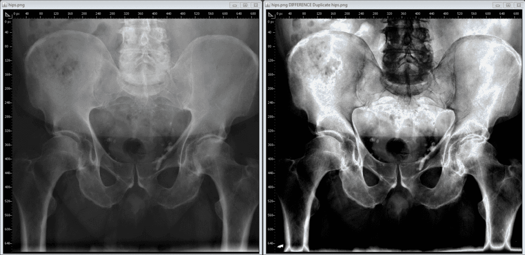 ¿Cuánto cuesta sacar una radiografía? 2 cuanto cuesta sacar una radiografia