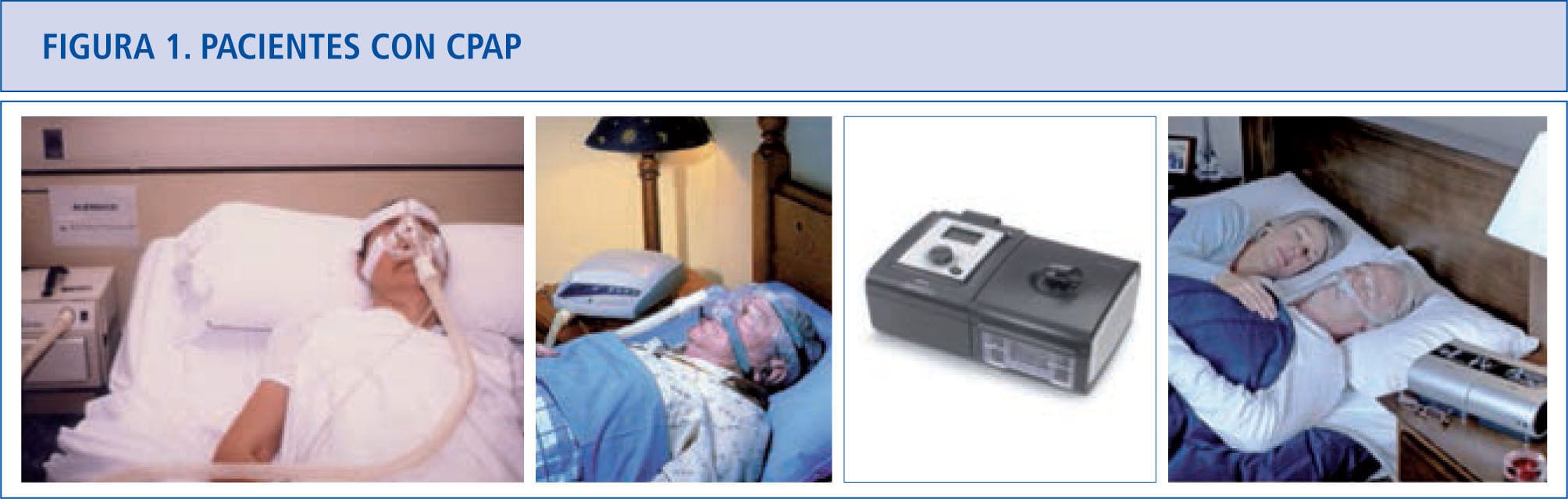 Blog 10 cuanto cuesta un cpap