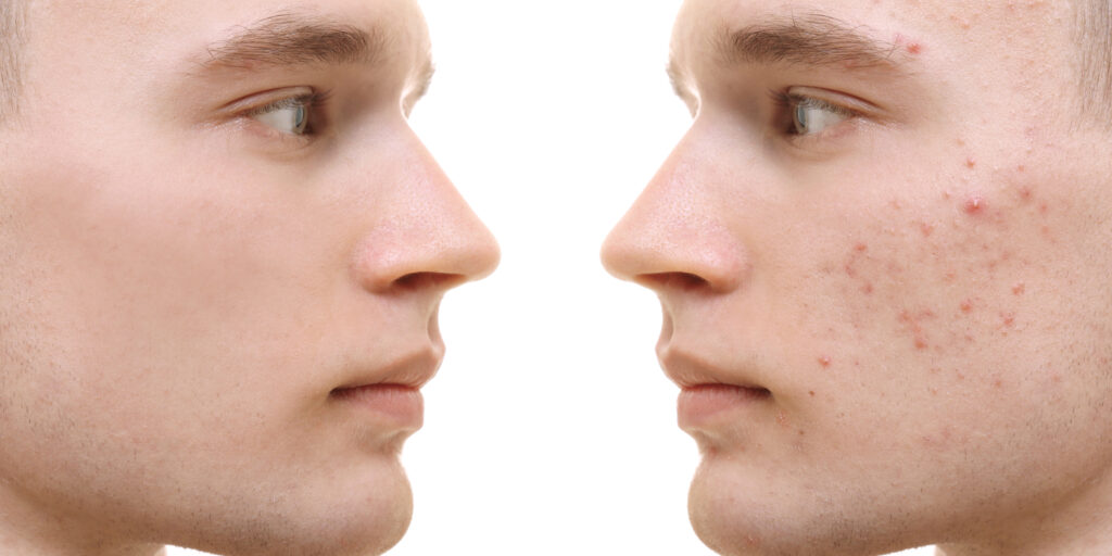 ¿Cuánto cuesta un dermatólogo? 2 cuanto cuesta un dermatologo