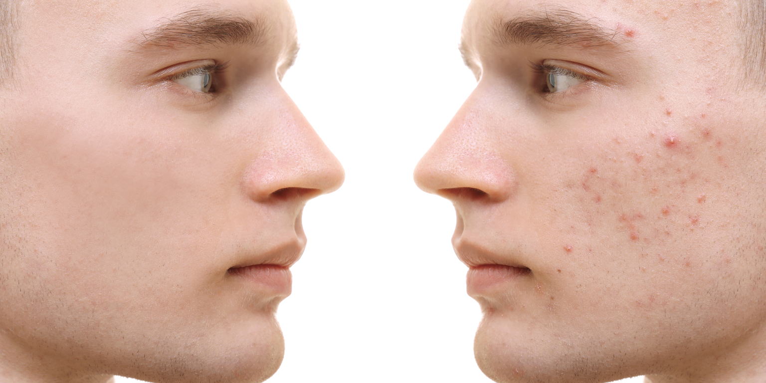 cuanto cuesta un dermatologo