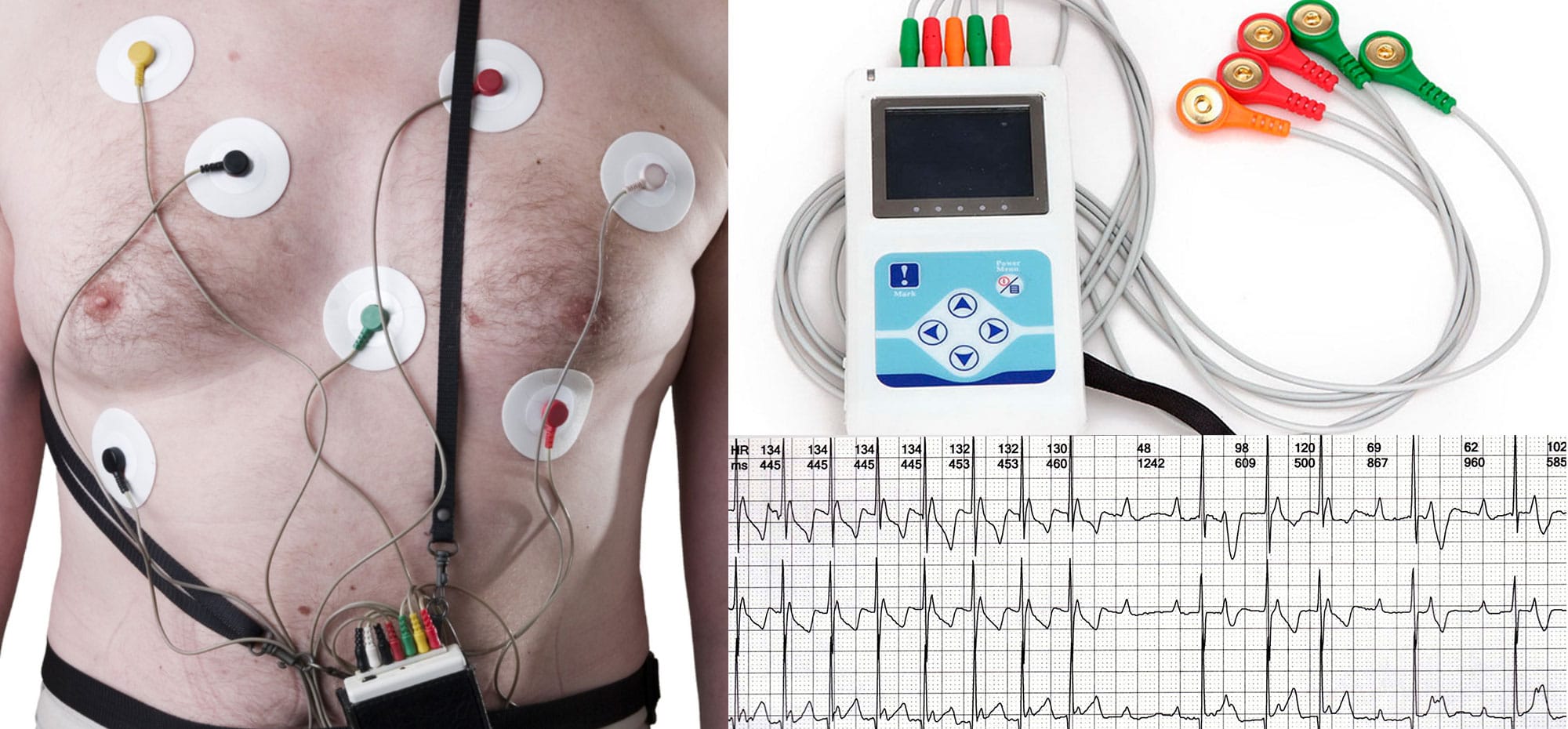 cuanto cuesta un holter