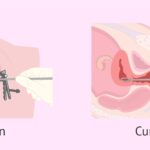 ¿Cuánto cuesta un papanicolau particular? cuanto-cuesta-un-papanicolau-particular