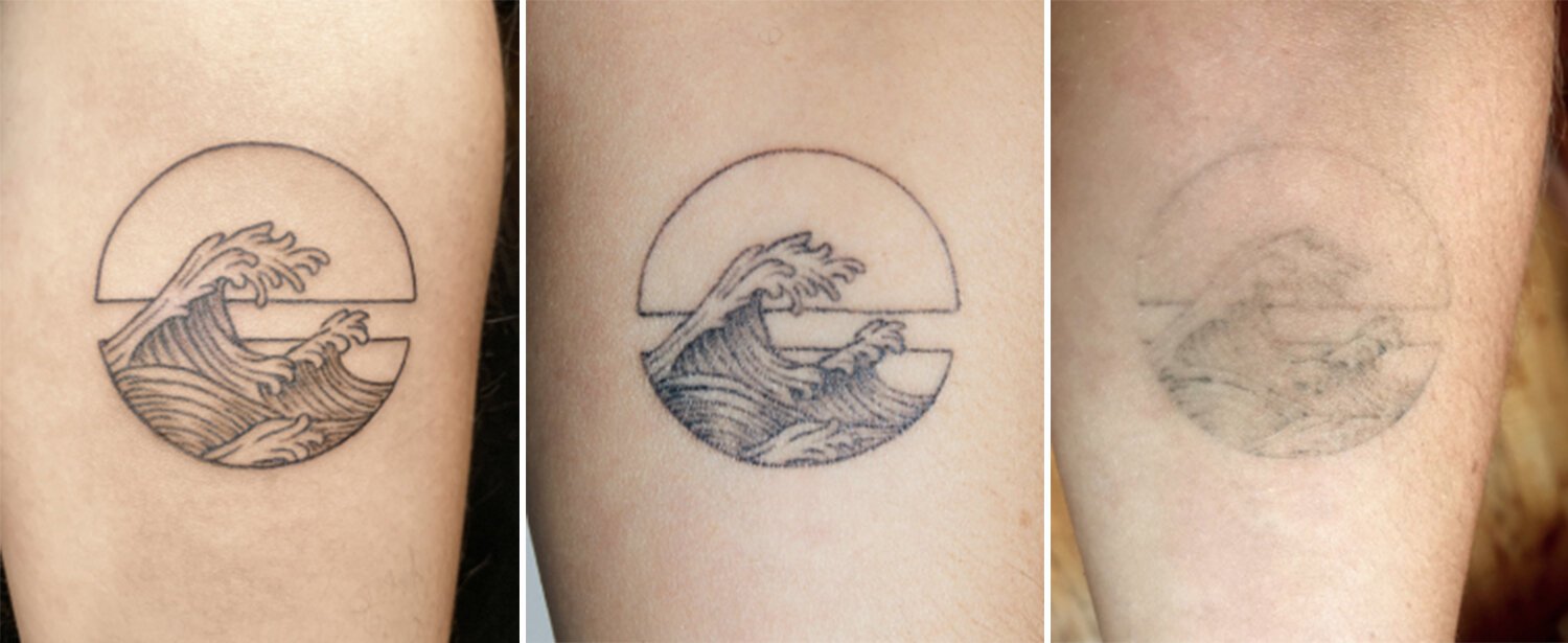 Blog 6 cuanto cuesta un tatuaje