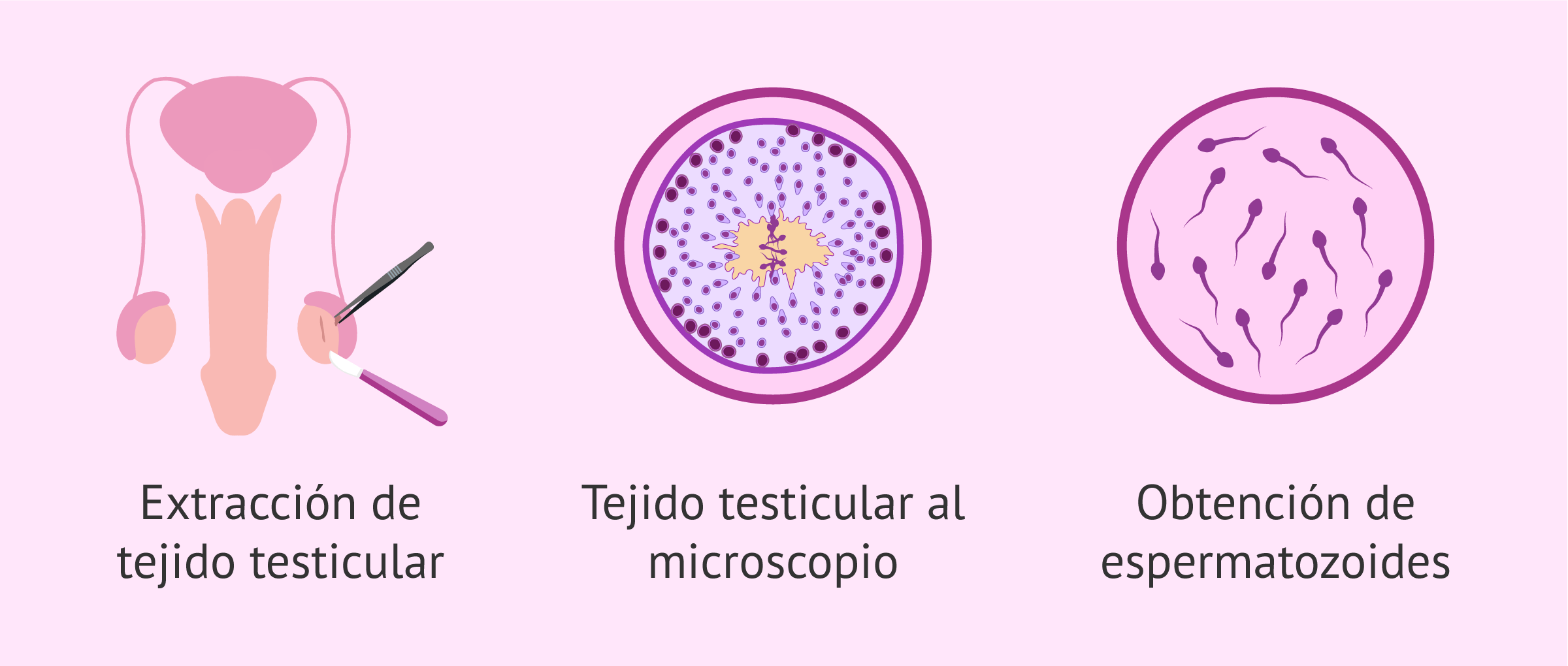 cuanto cuesta un testiculo
