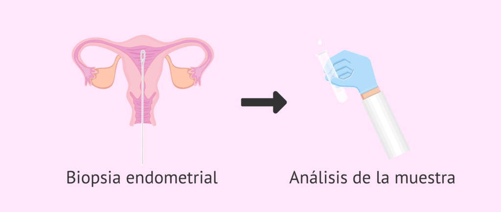 cuanto cuesta una biopsia endometrial