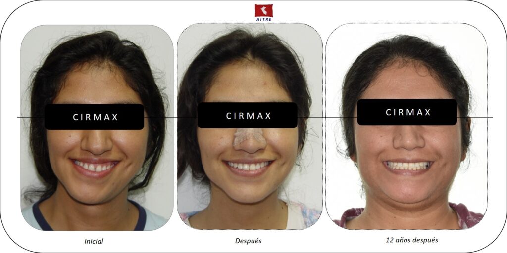 ¿Cuánto cuesta una cirugía maxilofacial? 2 cuanto cuesta una cirugia maxilofacial