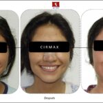 cuanto-cuesta-una-cirugia-maxilofacial