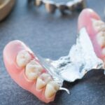 cuanto-cuesta-una-dentadura-postiza