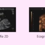 cuanto-cuesta-una-ecografia