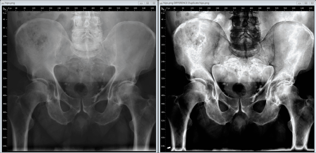 cuanto cuesta una radiografia