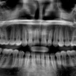 cuanto-cuesta-una-radiografia-dental
