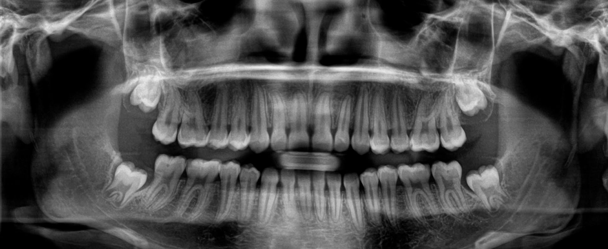 cuanto cuesta una radiografia dental