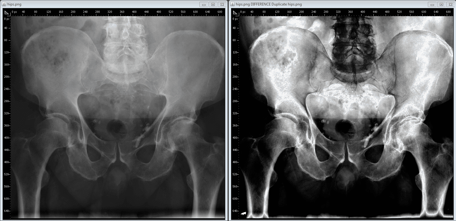cuanto cuesta una radiografia