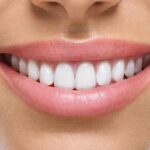 cuanto-cuesta-una-resina-dental