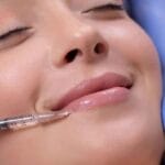 cuanto-dura-el-acido-hialuronico