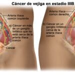 Cuánto dura la terapia vac? cuanto-dura-la-terapia-vac