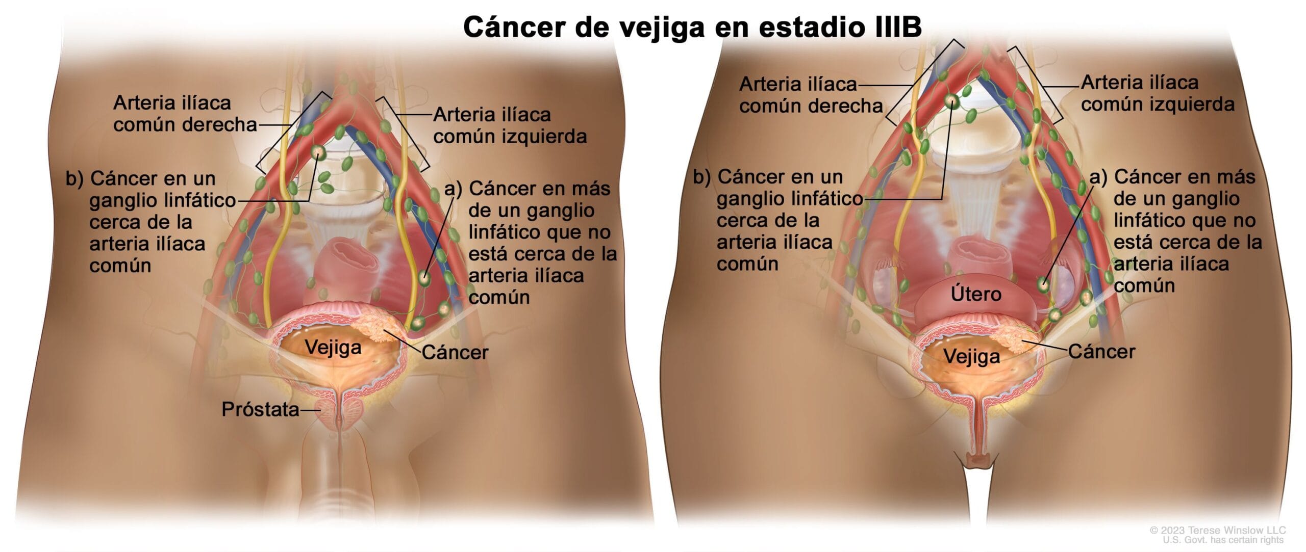 cuanto dura la terapia vac scaled