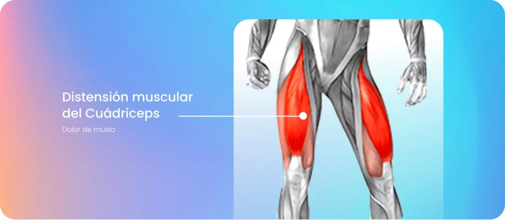 cuanto dura un desgarro muscular