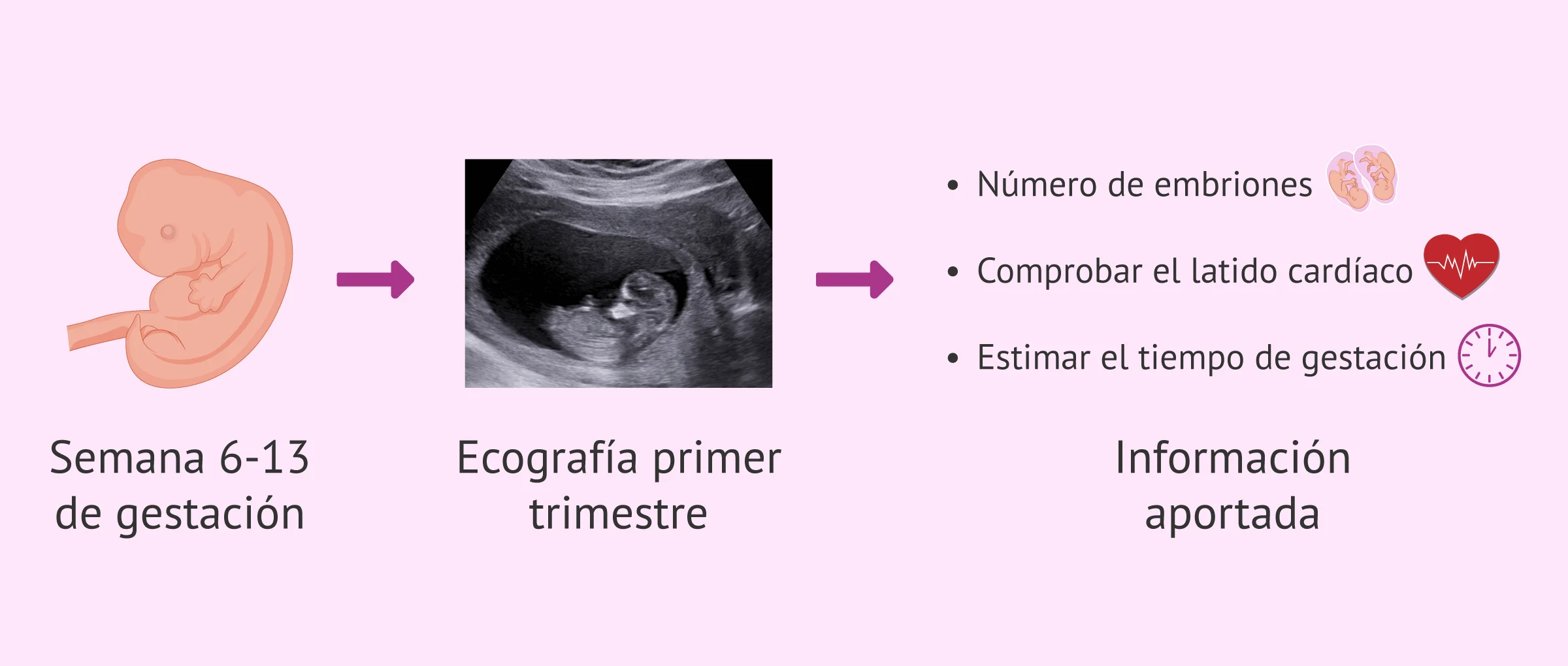 cuanto dura un ultrasonido