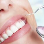 cuanto-dura-una-limpieza-dental