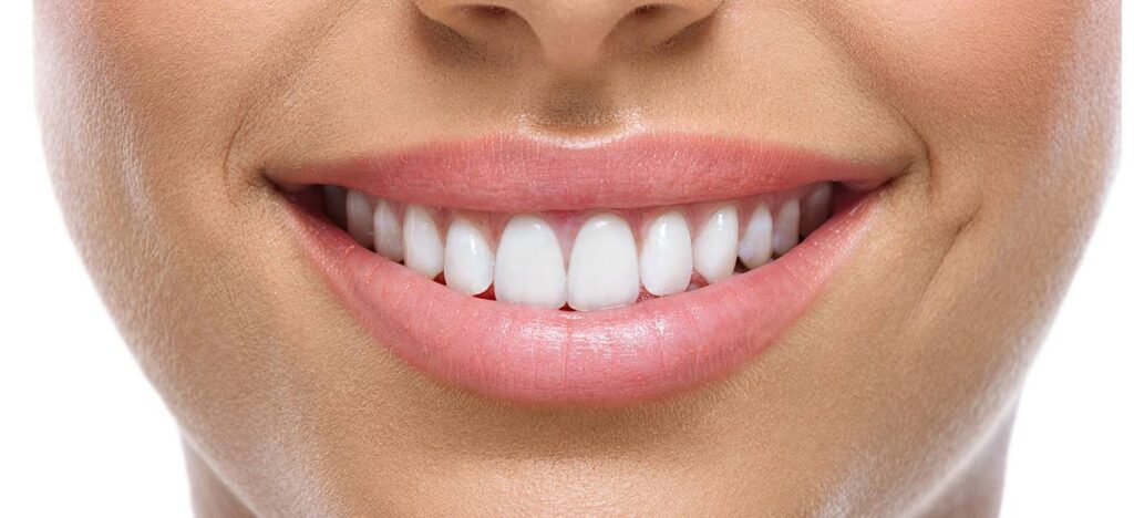cuanto dura una resina dental