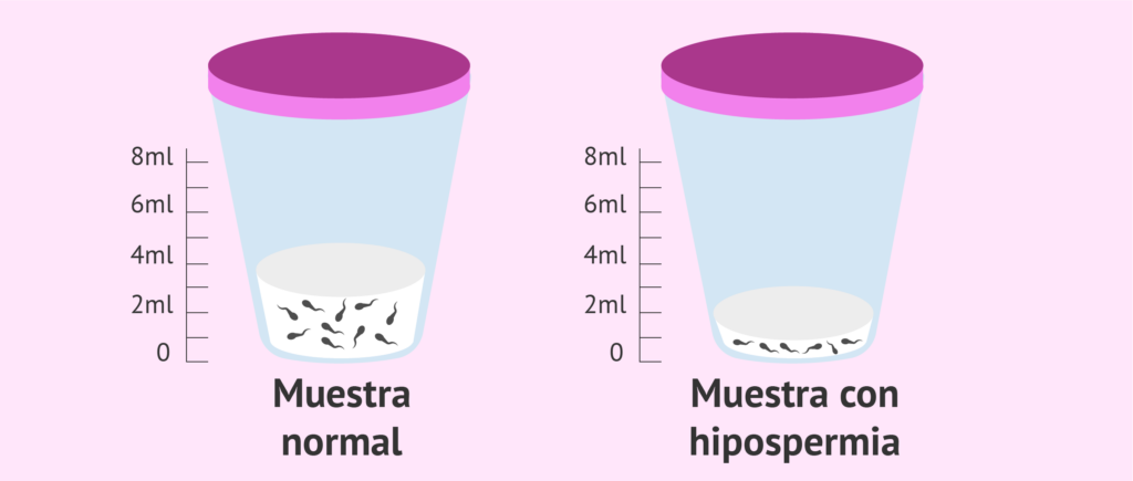 cuanto es 2 5 ml