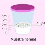 ¿Cuánto es 2 ml? cuanto-es-2-ml