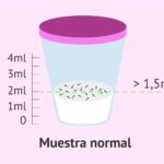 cuanto-es-5-ml