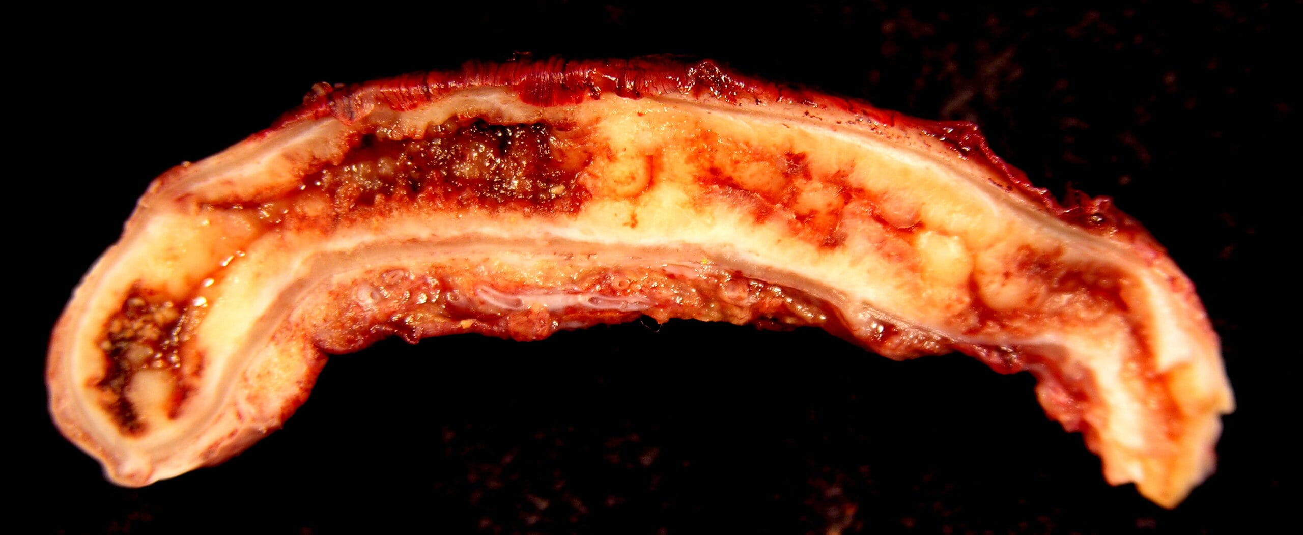 Blog 6 cuanto mide el apendice scaled