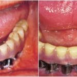 cuanto-mide-la-lengua