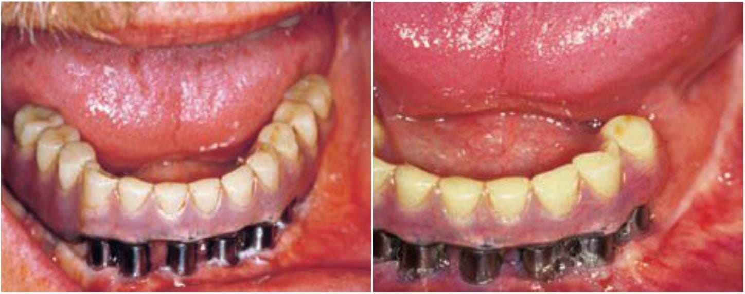 cuanto mide la lengua