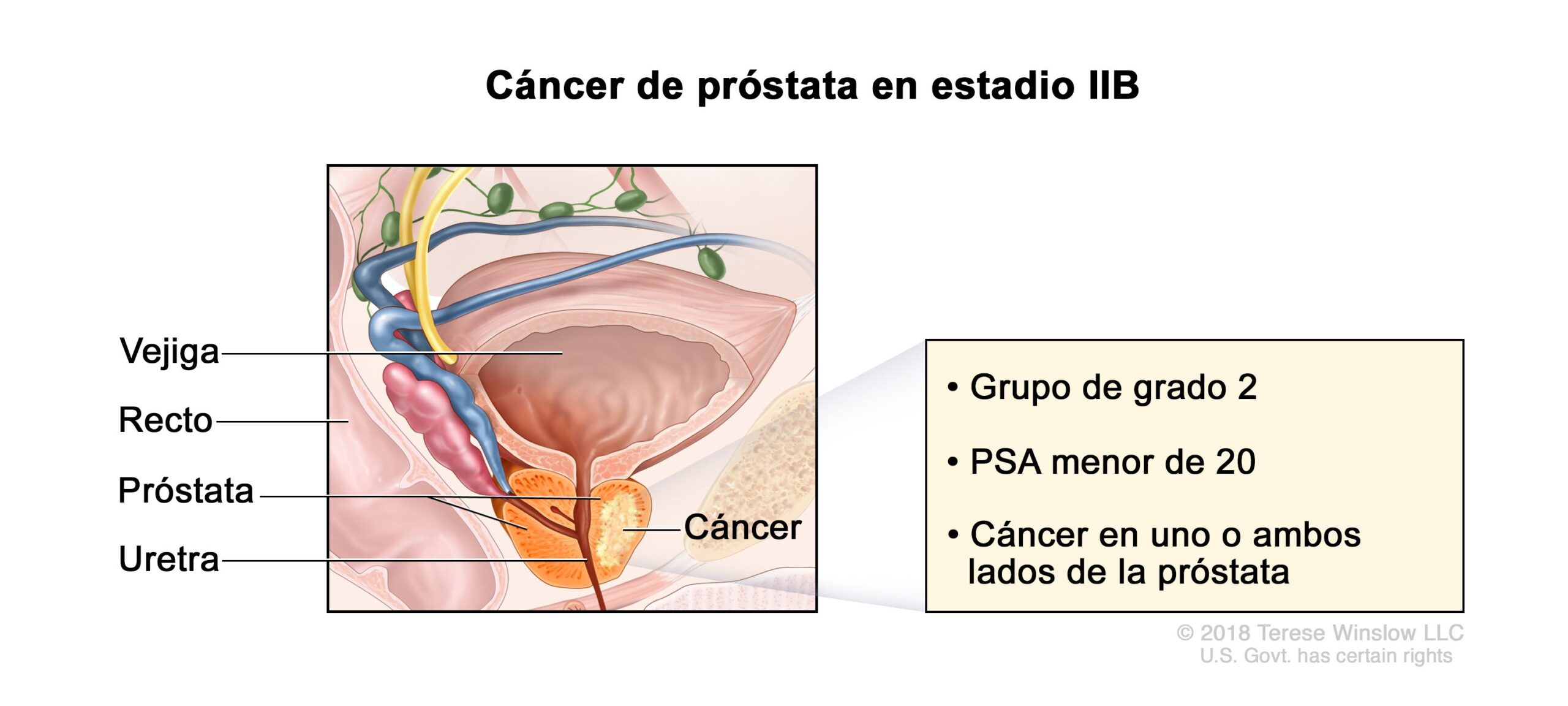 cuanto mide la prostata scaled
