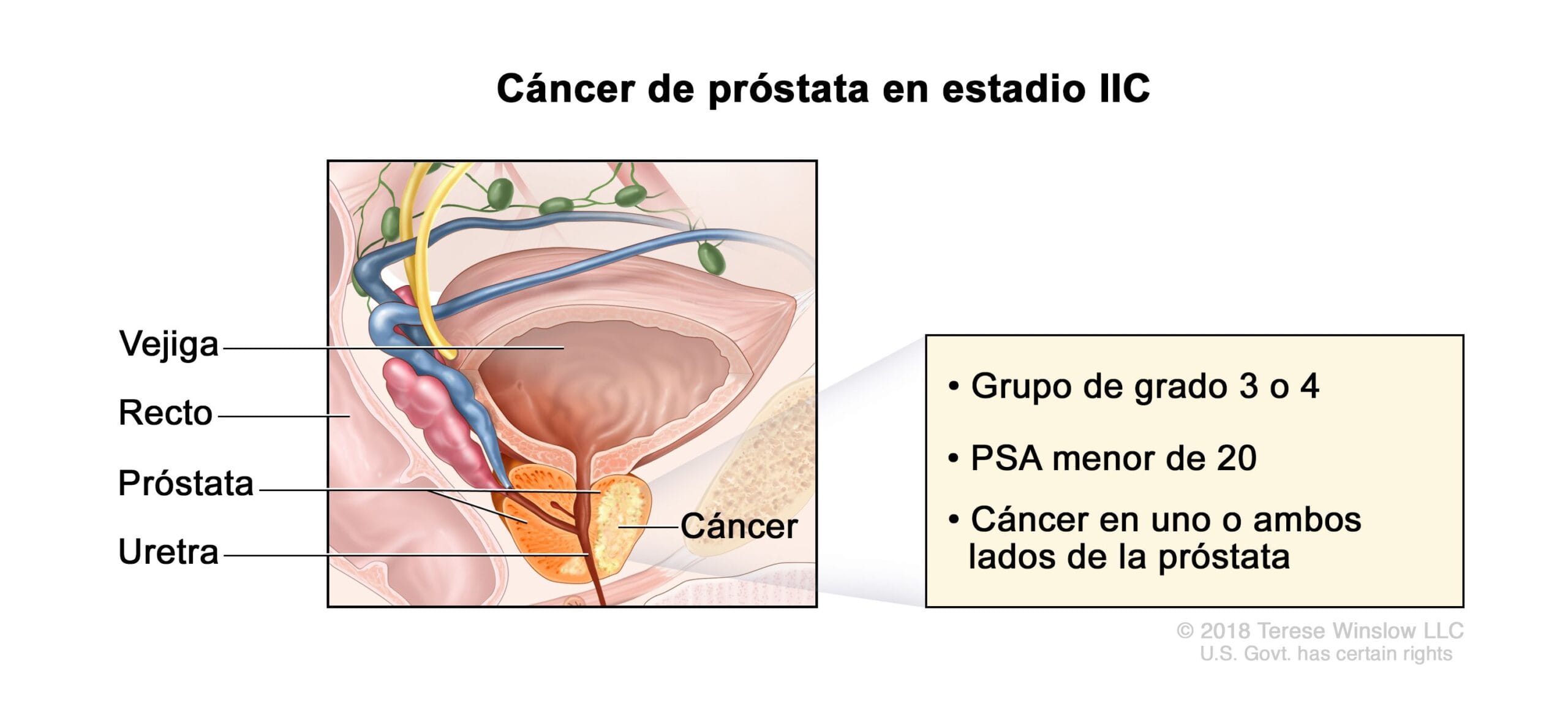 cuanto pesa la prostata scaled