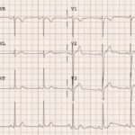 cuanto-sale-un-electrocardiograma