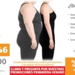 ¿Cuánto sale una manga gástrica? cuanto-sale-una-manga-gastrica