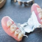 cuanto-sale-una-protesis-dental