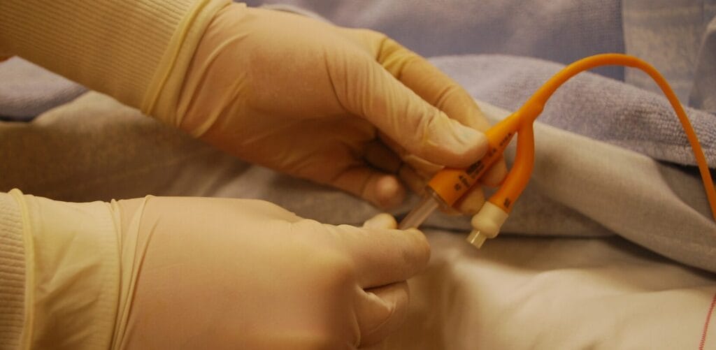 cuanto tarda un cateterismo cardiaco