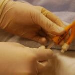 cuanto-tarda-un-cateterismo-cardiaco