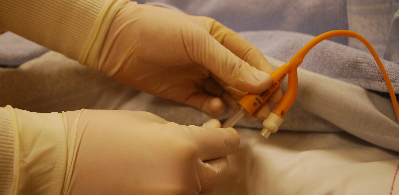 cuanto tarda un cateterismo cardiaco