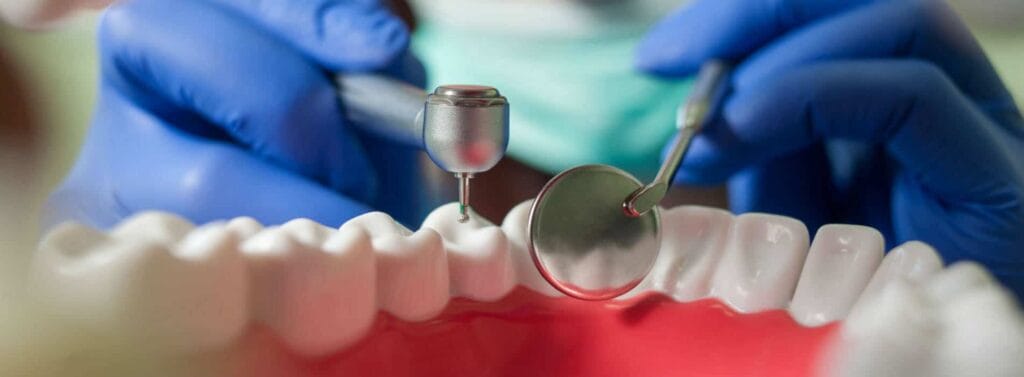 ¿Cuánto tiempo dura una endodoncia? 2 cuanto tiempo dura una endodoncia