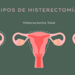 cuanto-tiempo-dura-una-histerectomia
