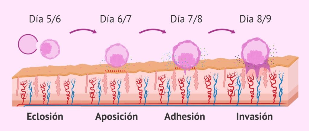 Cuánto tiempo tarda la implantación? 2 cuanto tiempo tarda la implantacion