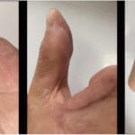 cuanto-vale-el-dedo-pulgar