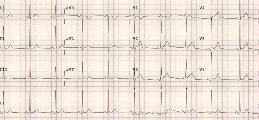 cuanto vale un electrocardiograma